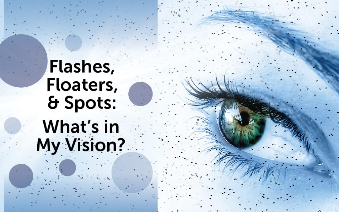 Do you see spots in your vision?